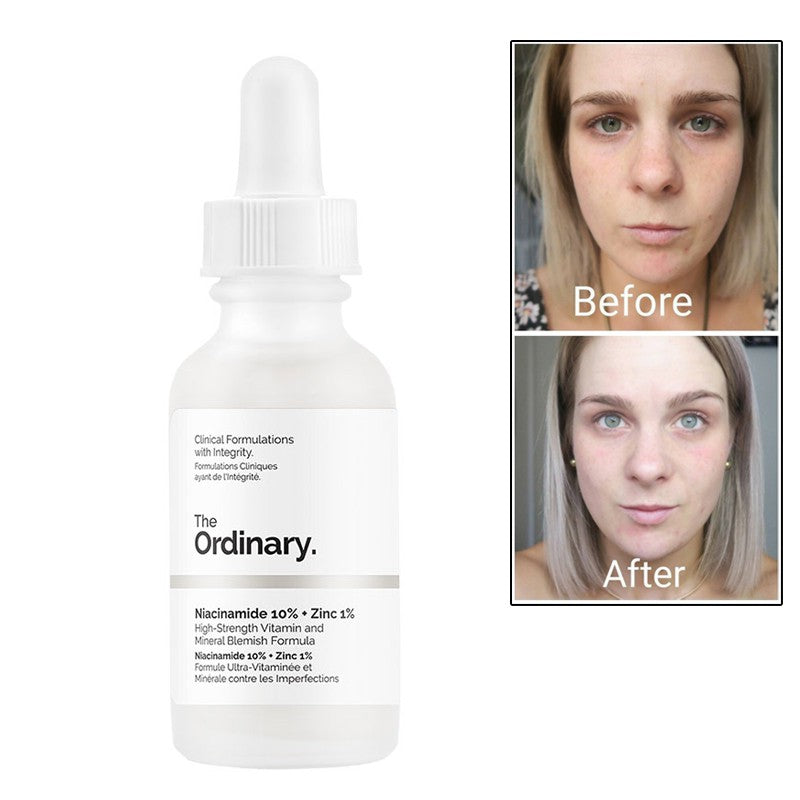 The Ordinary Niacinamide 10% + Zinc 1% (canda)