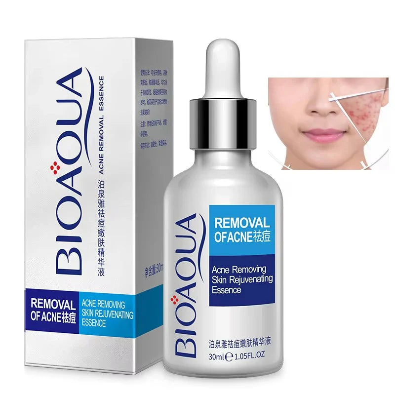 Bioaqua Anti-Acne Serum Removal Of Acne Essence Liquid 30ML