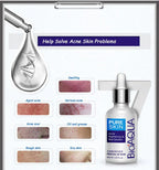 Bioaqua Anti-Acne Serum Removal Of Acne Essence Liquid 30ML