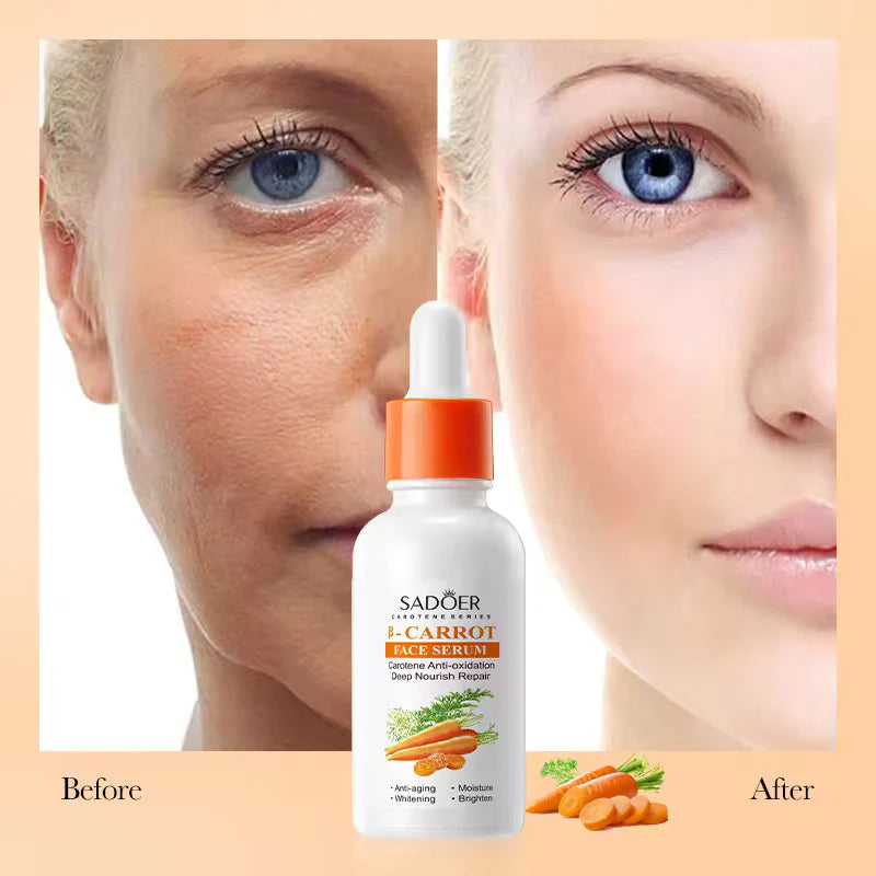 SADOER Carotene Soothing And Repairing B-Carrot Face Serum 30ml