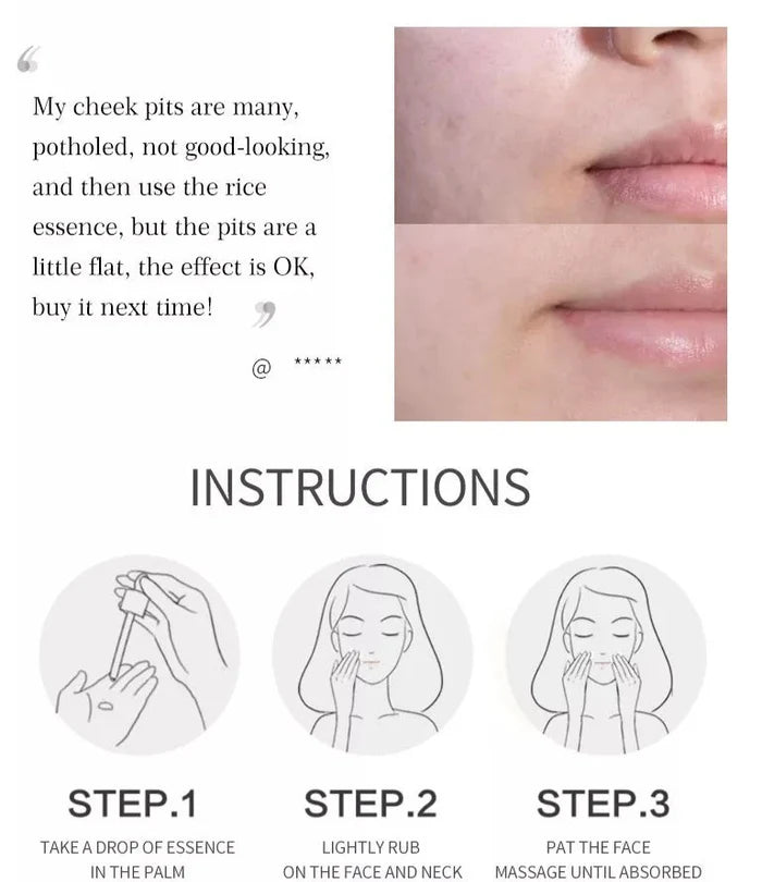 Aichun Beauty Moisturizing, Brightening and Anti Acne Rice Face Serum AC3122