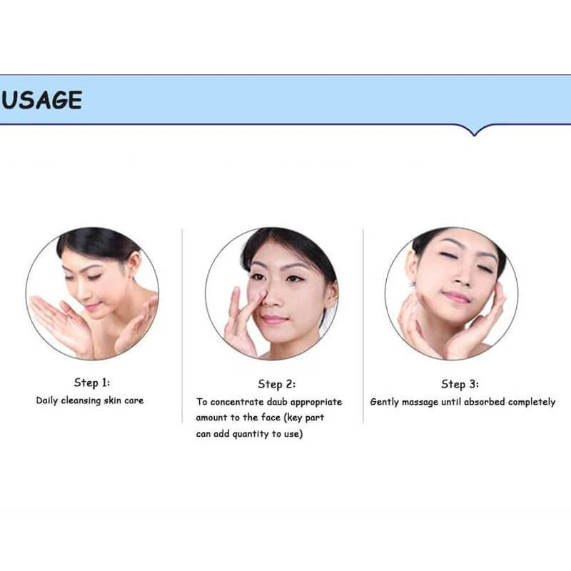 Bioaqua Anti-Acne Serum Removal Of Acne Essence Liquid 30ML